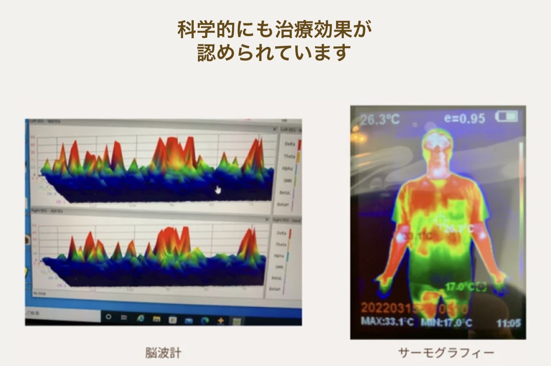 脳波計とサーモグラフィーによる施術前後の計測データ